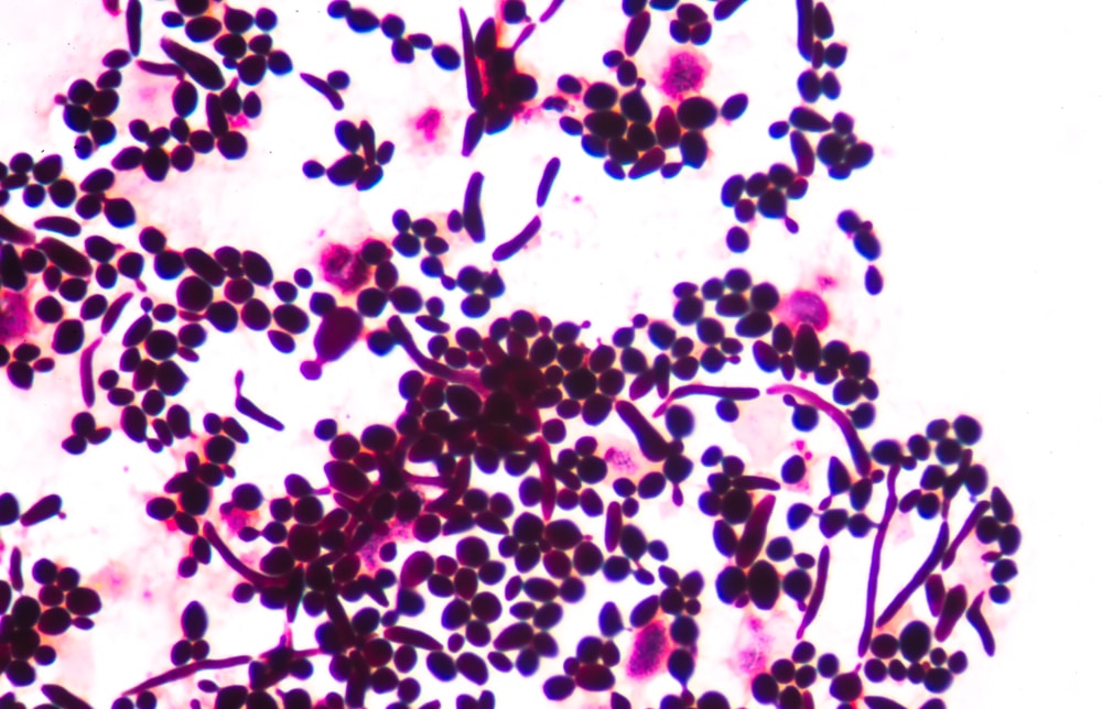 Винные дрожжи